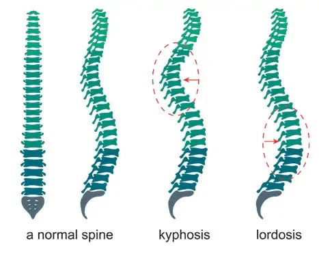 Back Pain Relief