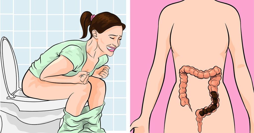 Constipation : Quick and Easy Remedies for Instant Relief!