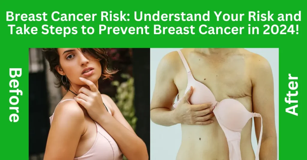 Breast Cancer Risk: Understand Your Risk and Take Steps to Prevent Breast Cancer in 2024!