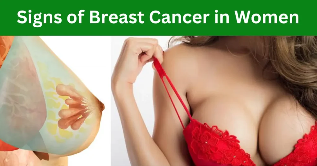 Signs of Breast Cancer in Women: Breast cancer can be cured at home by following the 13 principles mentioned in the article.