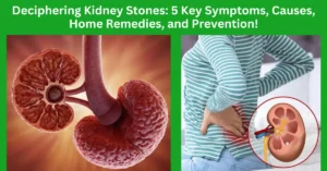 Deciphering Kidney Stones: 5 Key Symptoms, Causes, Home Remedies, and Prevention!
